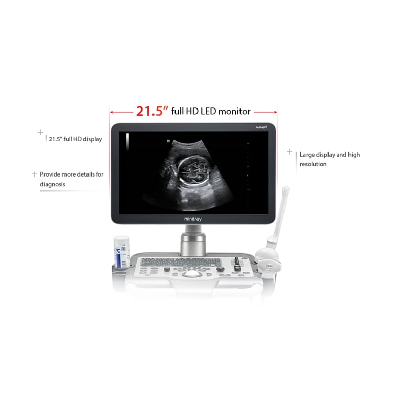 Mindray DC 30 klinisches Bildbeispiel Farbdoppler